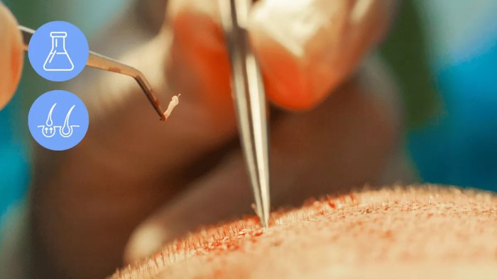 What are the risks of hair transplant surgery?